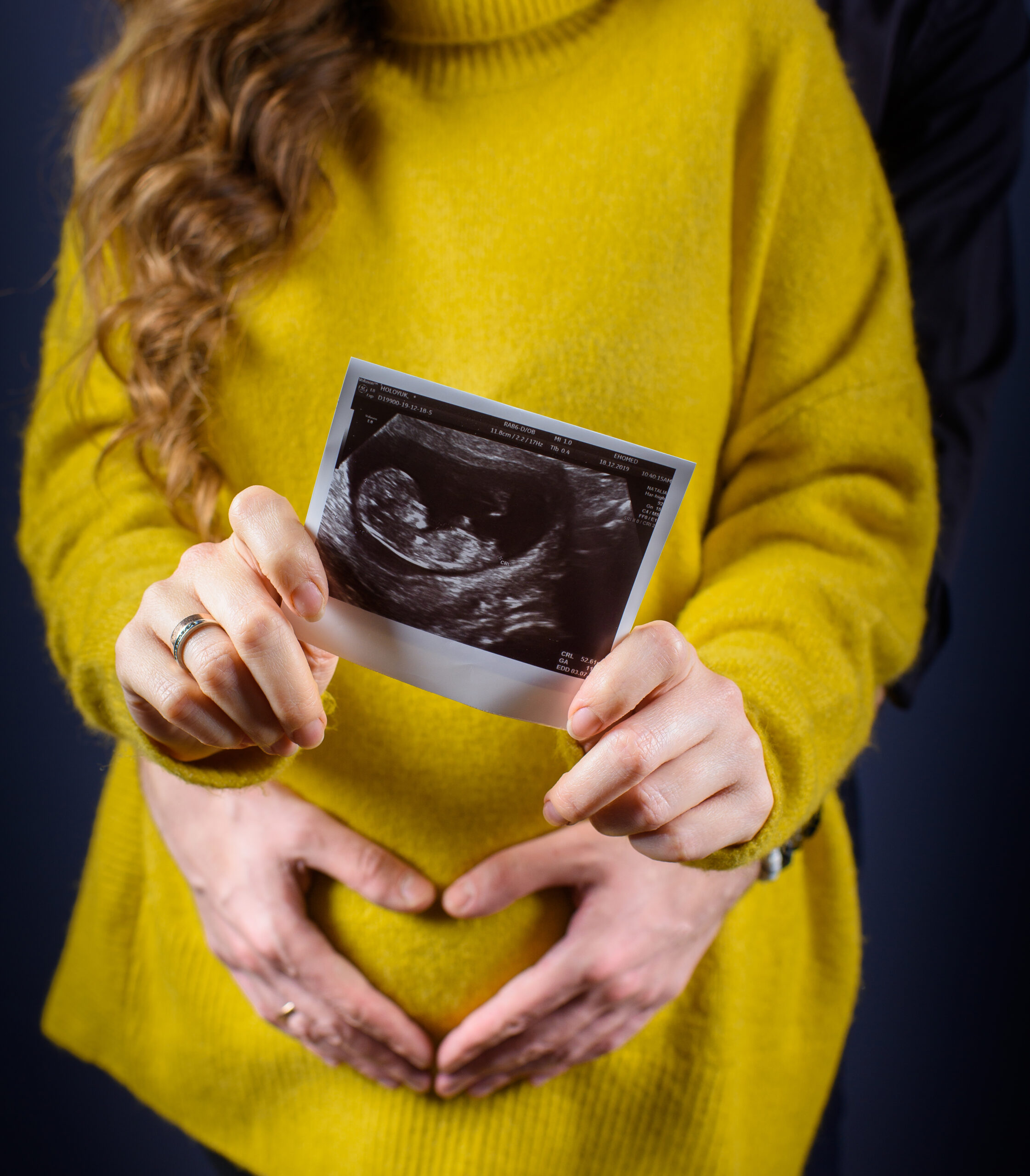 Front view of woman holding ultrasound image. Man hugging woman for her belly. Concept of pregnancy.